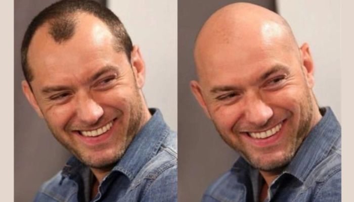 Aplicativo para Ficar Careca: Como Funciona e Por Que Está Fazendo Sucesso?