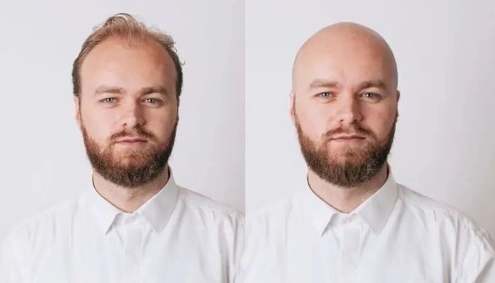 Bald App: How Does It Work and Why Is It a Success?